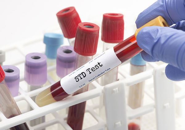 Std test Jackson County Health Department
